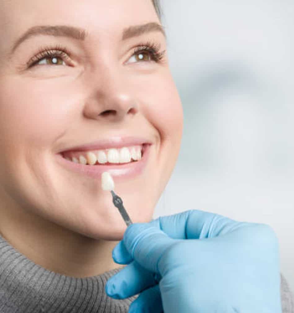 Minimal prep veneer consultation